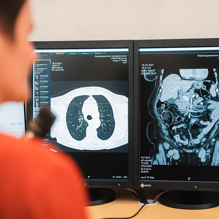 Betrachtung eines CT Scans auf einem Monitor im RadiologieZentrum Schwabmünchen